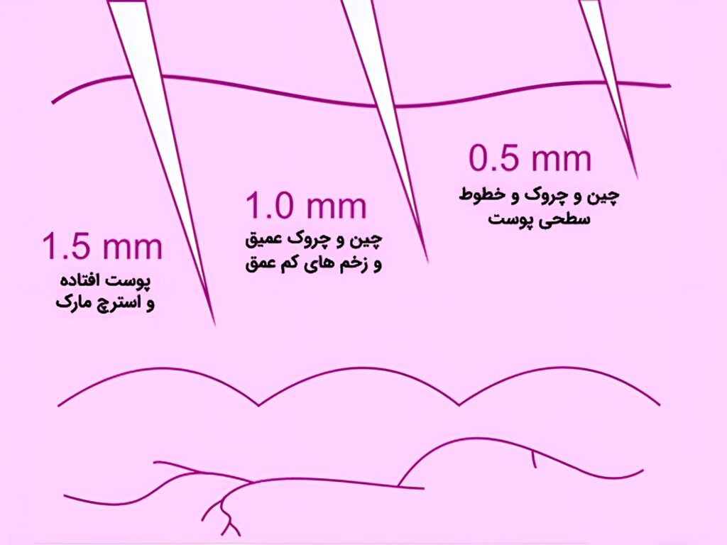 ماساژور درمارولر 5 در 1 مدل DRS